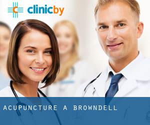 Acupuncture à Browndell