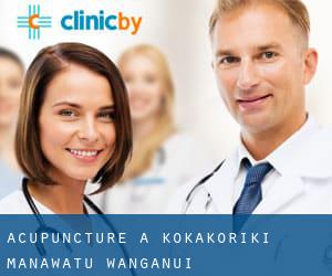 Acupuncture à Kokakoriki (Manawatu-Wanganui)