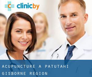 Acupuncture à Patutahi (Gisborne Region)